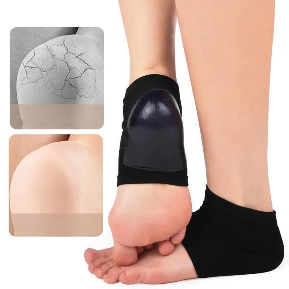 새로운 휴대용 갈라짐 방지 발뒤꿈치 보호 실리콘 보습  - Silicone Sock Hotend 리뷰 및 가격